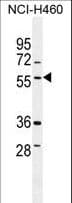 TSNARE1 Antibody (aa363-391)