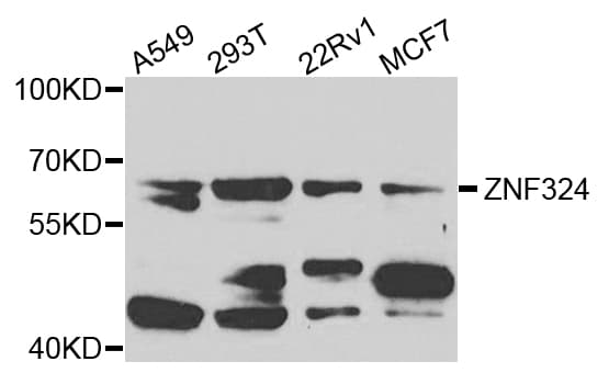 ZNF324 / ZF5128 Antibody