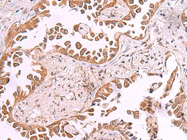 AK9 / AKD1 / AKD2 Antibody