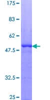 Human PDGF-AA Protein (Recombinant GST)