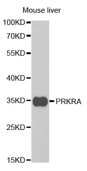 Polyclonal Rabbit anti-Human PRKRA / PACT Antibody (IHC, WB)