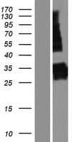 Human SYNPR / Synaptoporin Protein (Over-Expression Lysate Myc-DDK (Flag))