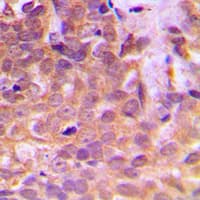 STAT5 A+B Antibody (Internal)