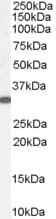 IHC-plus™ VDAC2 Antibody (aa298-309)