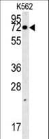 Polyclonal Rabbit anti-Human SLC7A10 / Asc-1 Antibody (aa495-523, WB)