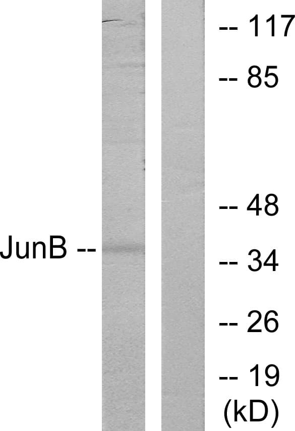 IHC-plus™ Polyclonal Rabbit anti-Human JUNB / JUN-B Antibody (aa226-275, IHC, WB)