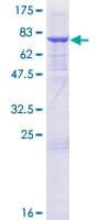 Human TRMT11 Protein (Recombinant GST)