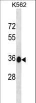 MMACHC Antibody (aa239-267)
