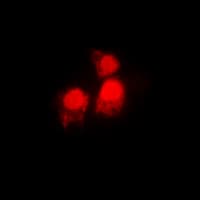 IHC-plus™ Polyclonal Rabbit anti-Human SIAH2 Antibody (C-Terminus, IHC, IF, WB)