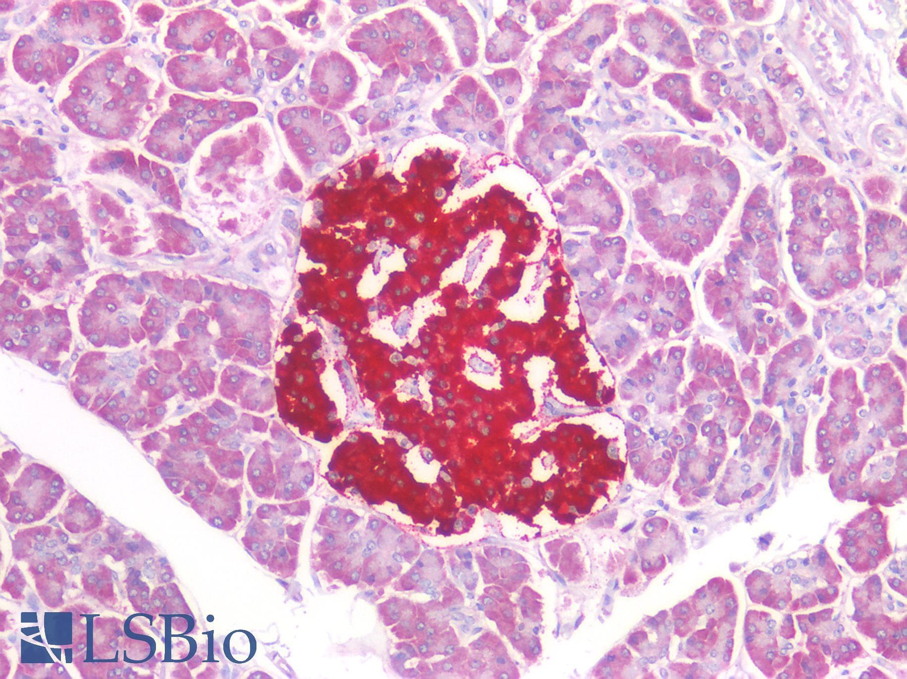IHC-plus™ IPO5 / RANBP5 Antibody