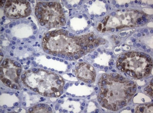 Monoclonal Mouse anti-Human CTSL / Cathepsin L Antibody (clone OTI6B8, Carrier-free, IHC, WB)