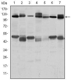 Monoclonal Mouse anti-Human c-CBL Antibody (clone 3B12, IHC, IF, WB)