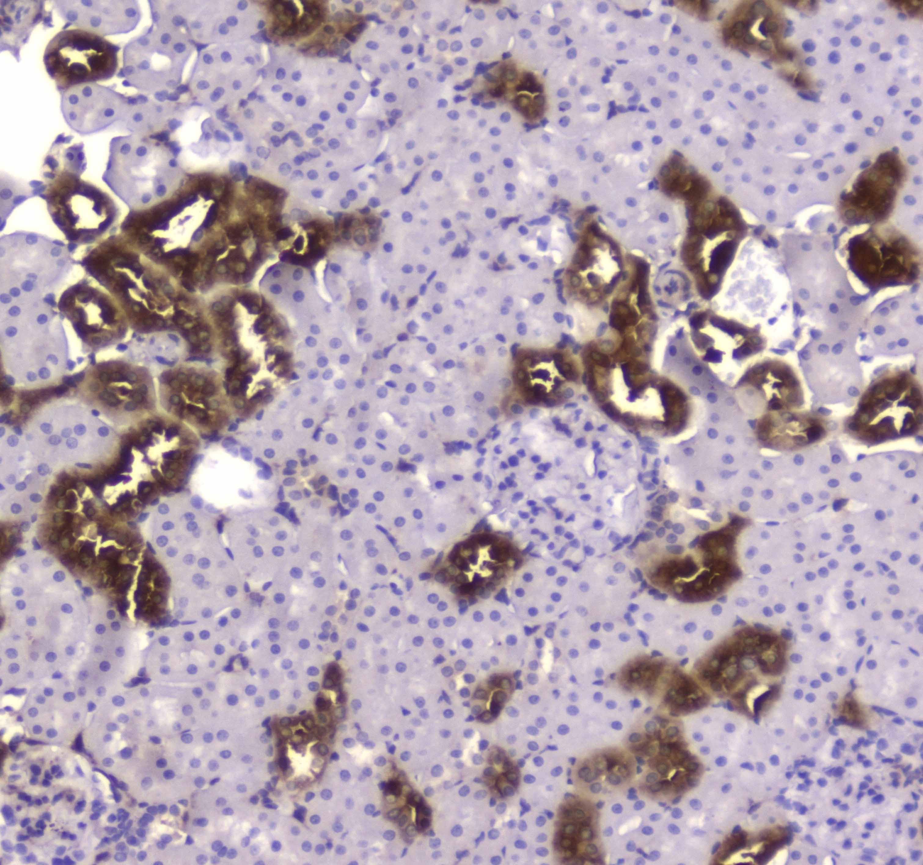 CKB / Creatine Kinase BB Antibody