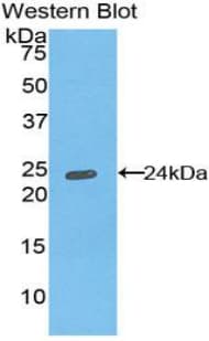 HLA-DRA Antibody (aa25-216, Cy3)