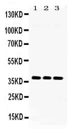 LDHB / Lactate Dehydrogenase B Antibody