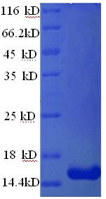 Human TSPAN7 / CD231 Protein (Recombinant His)