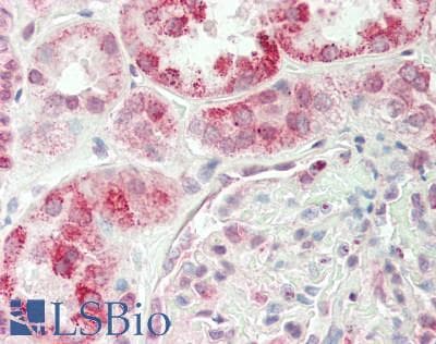Polyclonal Rabbit anti-Human RPN1 / Ribophorin I Antibody (aa468-517, IHC, WB)