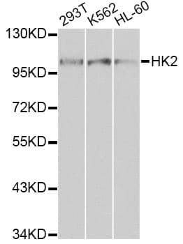 IHC-plus™ Polyclonal Rabbit anti-Human HK2 / Hexokinase 2 Antibody (IHC, IF, WB)