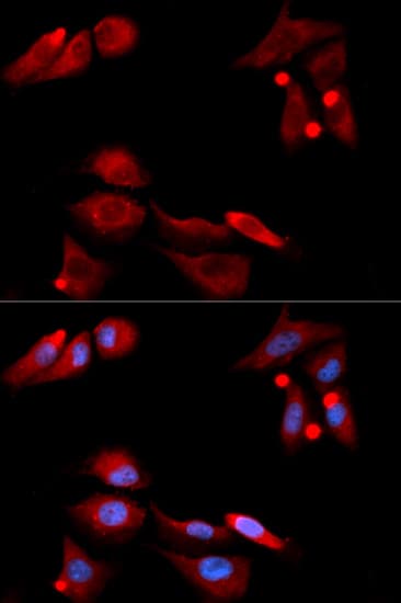 Polyclonal Rabbit anti-Human GFRA1 / GFR Alpha Antibody (IHC, IF, WB)