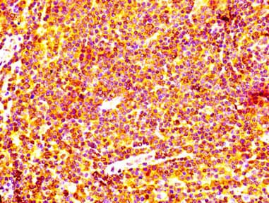 Recombinant Monoclonal Rabbit anti-Human BCL2 / Bcl-2 Antibody (IHC, WB)