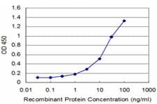 SNAI1 / SNAIL-1 Antibody (clone 2G11)