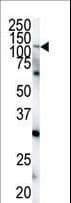 PathPlus™ EPHA4 / EPH Receptor A4 Antibody (aa40-70)