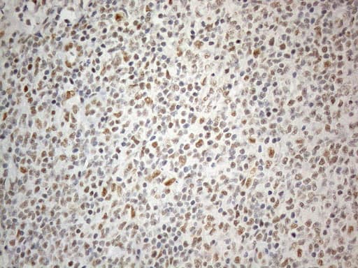 Monoclonal Mouse anti-Human CWC27 Antibody (clone OTI4C8, aa145-472, IHC, WB)