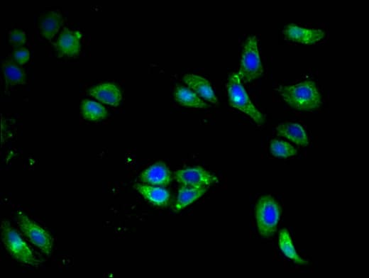 CD79A / CD79 Alpha Antibody