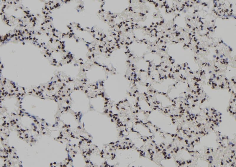 Polyclonal Rabbit anti-Human KLF4 Antibody (IHC, WB)