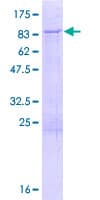 Human LARP6 / ACHN Protein (Recombinant GST)