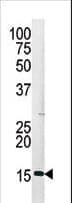 Histone H3 Antibody (phospho-Ser28)