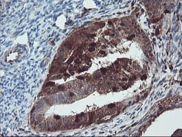 SERPINB1 Antibody (aa77-306, clone OTI2B4)