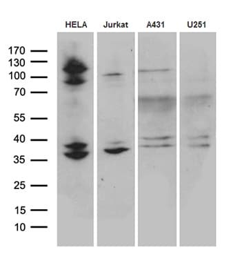 Monoclonal Mouse anti-Human SUGT1 / SGT1 Antibody (clone OTI10A9, WB)