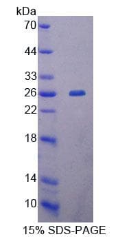 Human MTERF1 Protein (Recombinant His-T7)