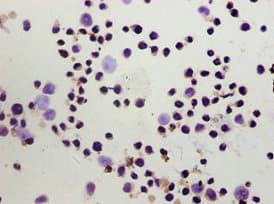 Polyclonal Rabbit anti-Human FOXP3 Antibody (IHC, WB)