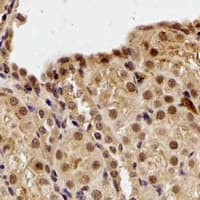 Polyclonal Rabbit anti-Human DDB1 Antibody (IHC, WB)