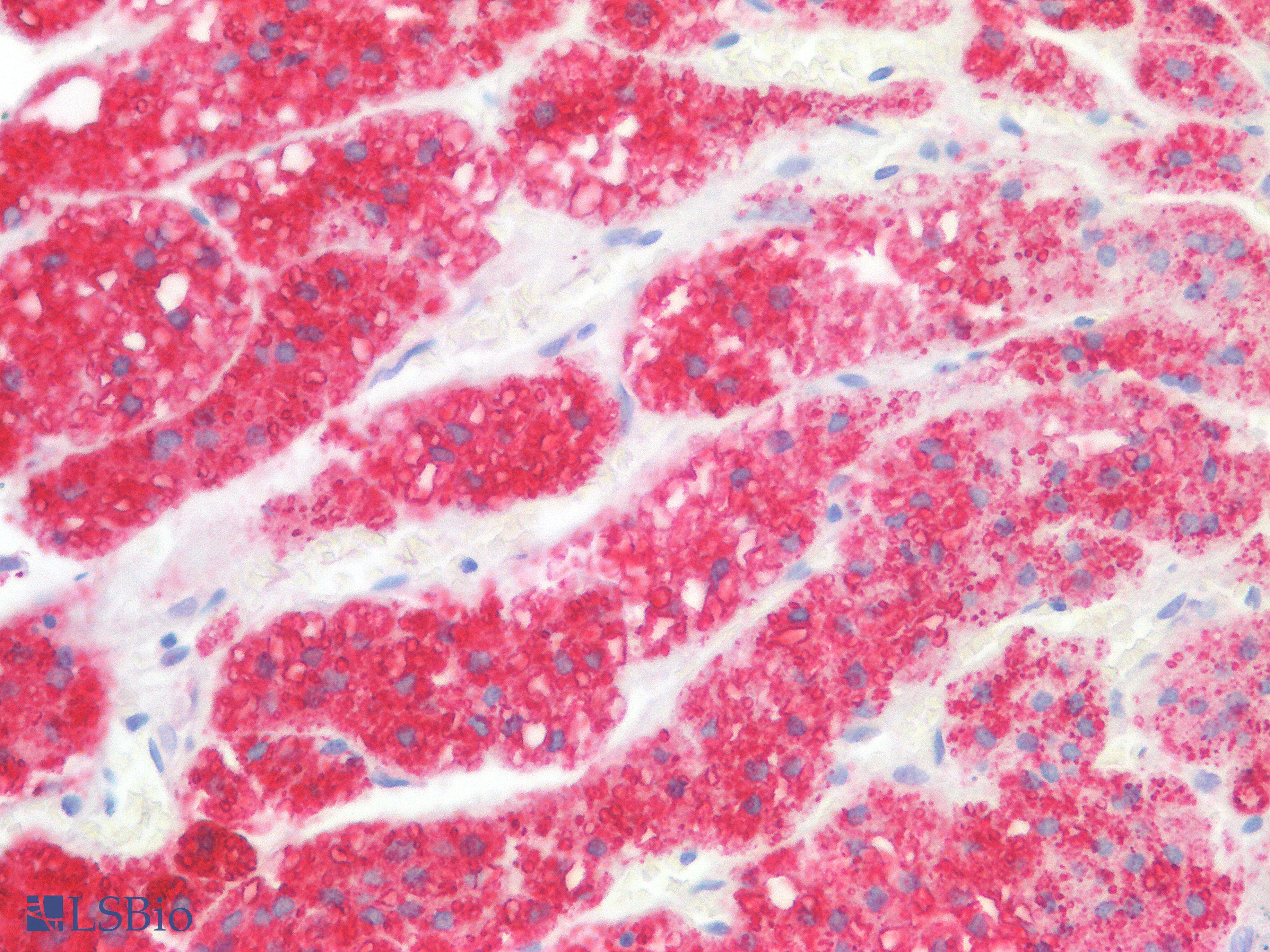 PathPlus™ Polyclonal Rabbit anti-Human EPHX1 / Epoxide Hydrolase 1 Antibody (IHC, WB)