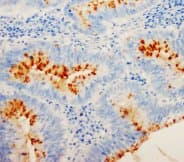 CDKN1B / p27 Kip1 Antibody (C-Terminus)