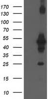 CCM2 / Malcavernin Antibody (clone OTI1E8, Carrier-free)