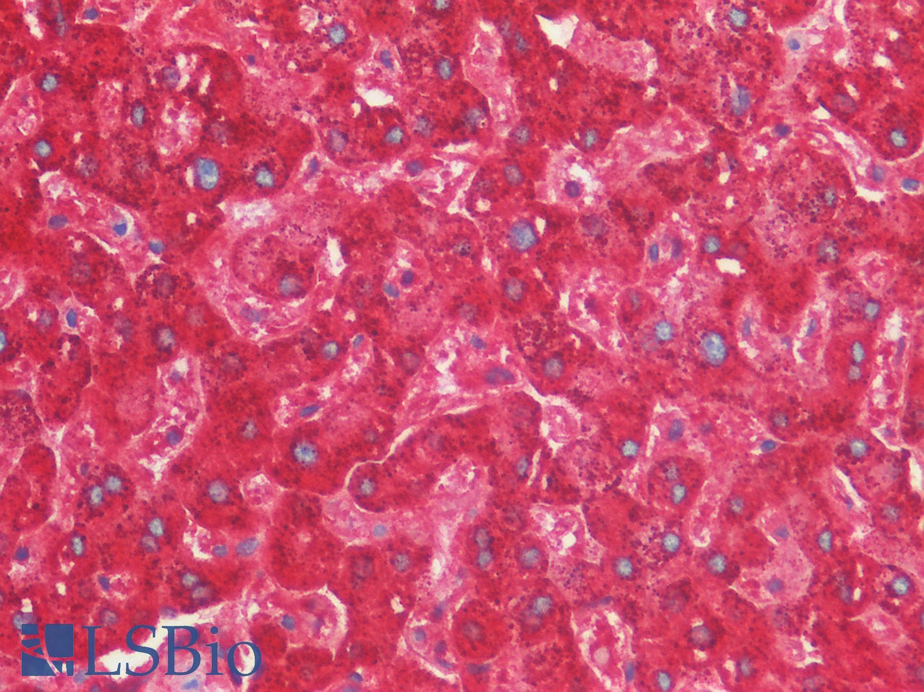 IHC-plus™ Polyclonal Rabbit anti-Human RARRES2 / Chemerin Antibody (N-Terminus, IHC, IF, WB)