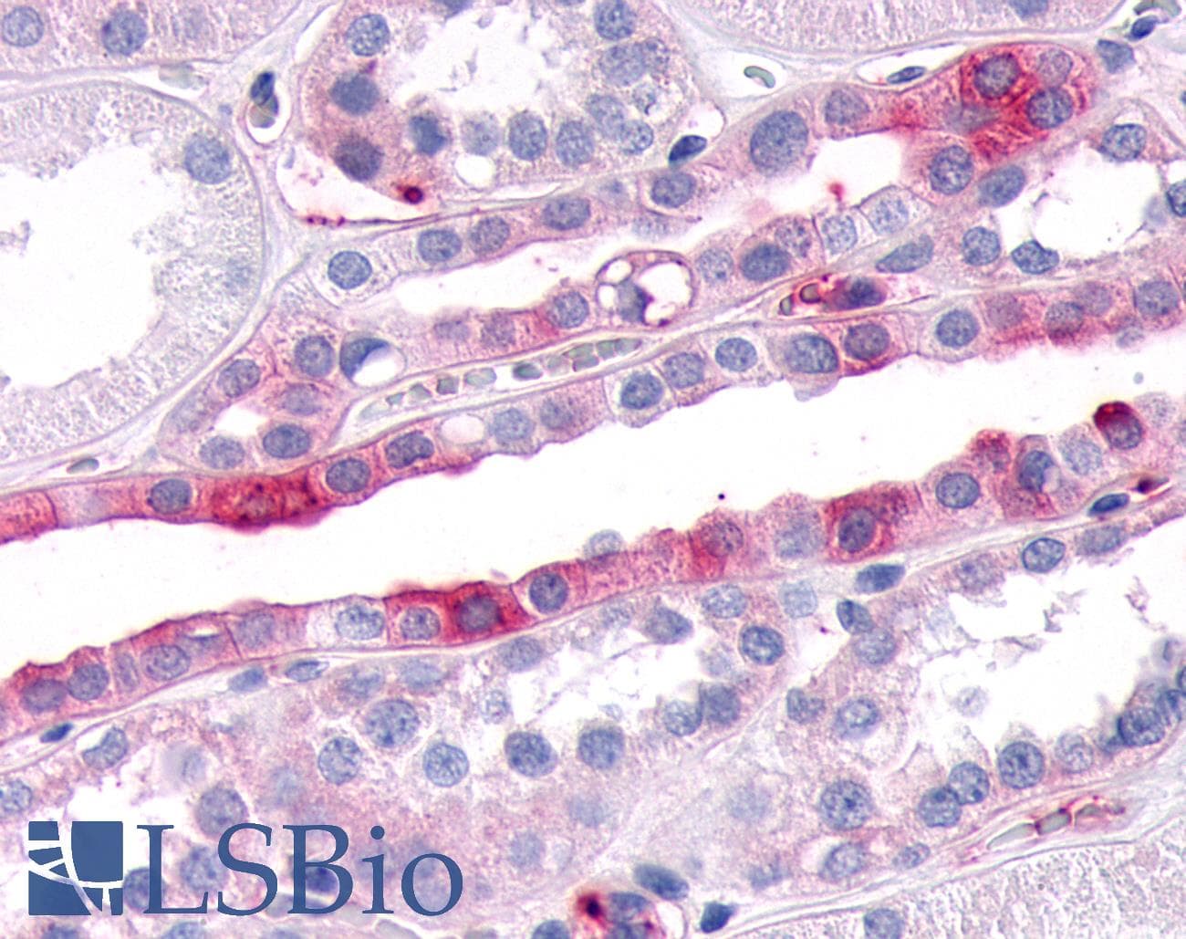 PathPlus™ SGK3 Antibody (N-Terminus)