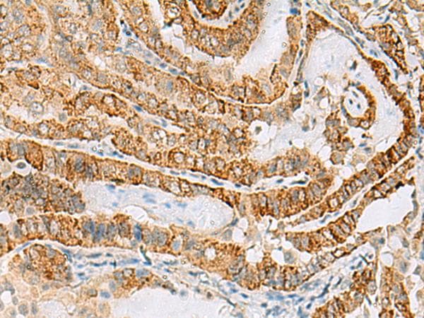 Polyclonal Rabbit anti-Human FARP2 / FRG Antibody (IHC)