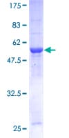 Human CDK2 Protein (Recombinant GST)