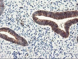 Latexin / MUM Antibody (clone OTI2G4, Carrier-free)