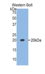 MMP9 / Gelatinase B Antibody (aa226-391)