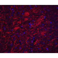 IHC-plus™ Polyclonal Rabbit anti-Human SYNPO / Synaptopodin Antibody (IHC, IF, WB)