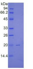 Human RNLS / Renalase Protein (Recombinant His)