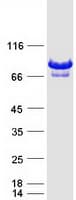 Human DEF6 Protein (Recombinant Myc-DDK (Flag))
