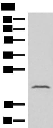 Polyclonal Rabbit anti-Human IFNA8 / Interferon Alpha 8 Antibody (WB)
