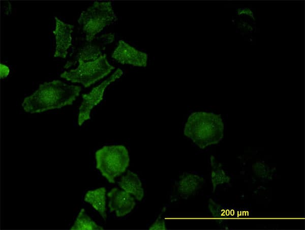 Monoclonal Mouse anti-Human P3H1 / LEPRE1 Antibody (clone 3C7, IHC, IF, WB)